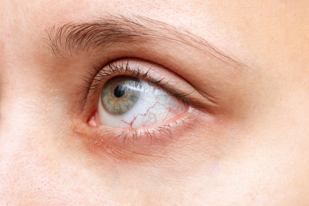 Uveitis and Autoimmune Diseases: Exploring the Connection
